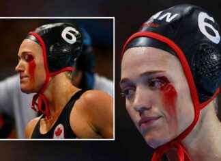 Olympic Water Polo Player Injured with Blood Pouring from Eye news-09082024-060716