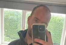 How a Hair Transplant Boosted My Confidence and Love Life news-09082024-071358