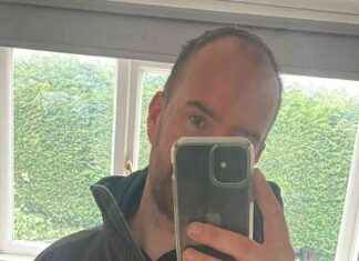 How a Hair Transplant Boosted My Confidence and Love Life news-09082024-071358