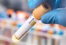 Hepatitis Outbreak in Lanarkshire: Warning of Life-Threatening Infection news-09082024-091748