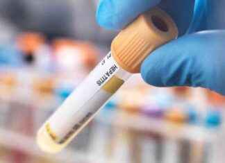 Hepatitis Outbreak in Lanarkshire: Warning of Life-Threatening Infection news-09082024-091748