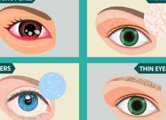 Warning Signs: Eye and Eyebrow Health Issues You Shouldn’t Ignore news-09082024-103332