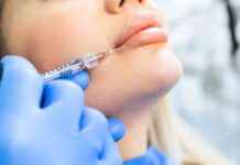 Warning: Beauty Fan Shares Scary Experience with Lip Filler Result news-09082024-110943