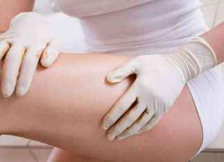 Achieve a Streak-Free Glow with This £1.20 ‘Walnut’ Fake Tan Hack news-09082024-111409