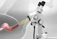 Colposcope Market Analysis and Forecast 2031 | DySIS, CooperSurgical, Atmos news-09082024-115127