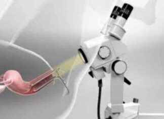 Colposcope Market Analysis and Forecast 2031 | DySIS, CooperSurgical, Atmos news-09082024-115127