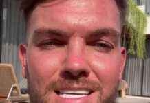 Geordie Shore Star Defends Natural-Looking £6k Turkey Teeth news-12082024-015045