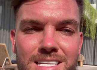 Geordie Shore Star Defends Natural-Looking £6k Turkey Teeth news-12082024-015045