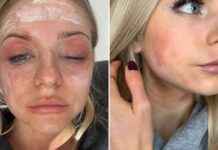 Traitors Star Reveals Unrecognisable Transformation Due to Secret Health Battle news-14082024-125310