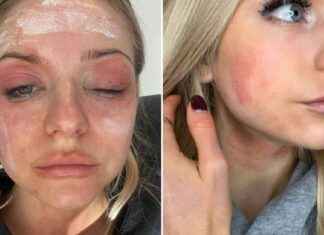 Traitors Star Reveals Unrecognisable Transformation Due to Secret Health Battle news-14082024-125310