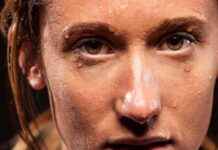 Clear Skin: How $17 Product Helped Me Stop Breakouts news-24082024-235910