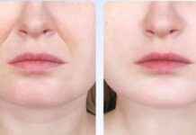 Transform Your Skin with Amazon’s Affordable Anti-Aging Gadget – See the Results at 38 news-12092024-213209