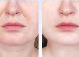 Transform Your Skin with Amazon’s Affordable Anti-Aging Gadget – See the Results at 38 news-12092024-213209