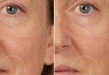 Top Liquid Botox Serum for Instant Wrinkle Reduction top-liquid-botox-serum-for-nstant-wrinkle-reduction