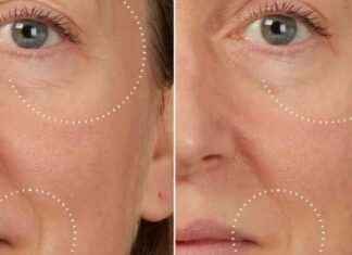 Top Liquid Botox Serum for Instant Wrinkle Reduction top-liquid-botox-serum-for-nstant-wrinkle-reduction